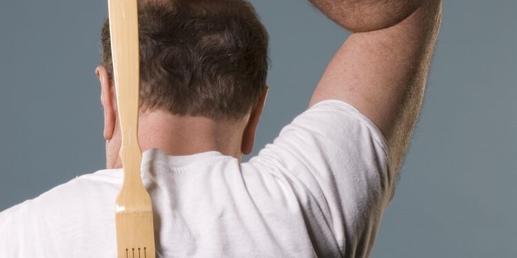 Remedios caseros para el eczema