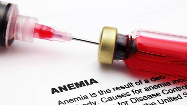 Síntomas de la anemia