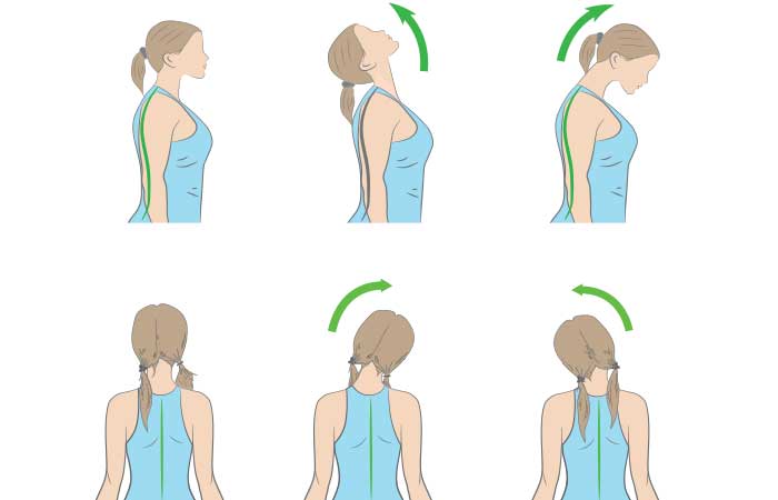 cómo deshacerse de un nervio pellizcado en el cuello