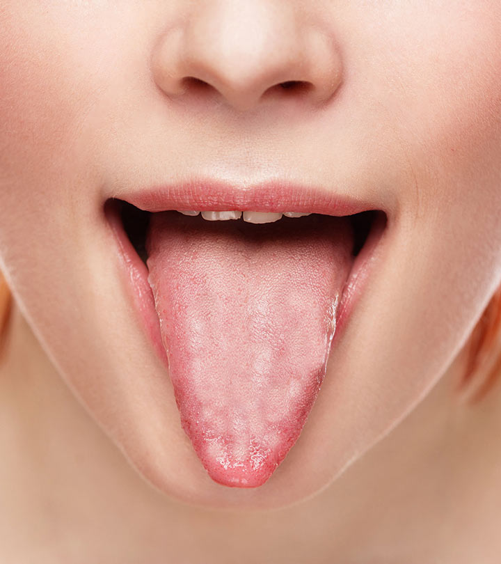 Remedios caseros eficaces para la lengua peluda