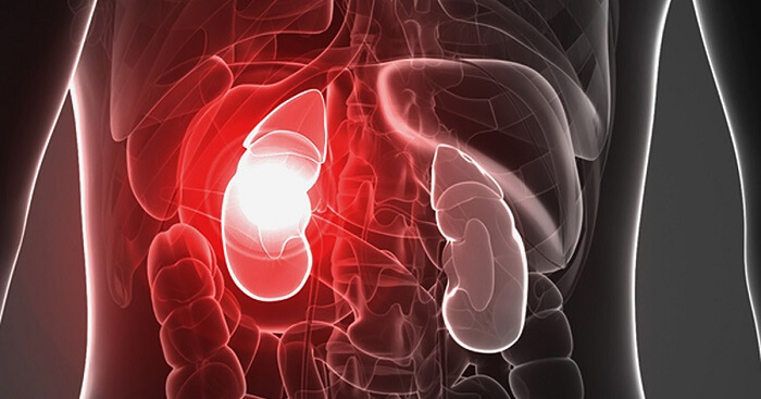 Insuficiencia renal